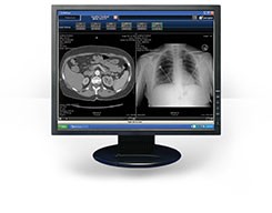 Software interface examples of x-rays and scans displayed on monitor.