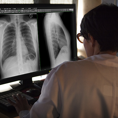 man looking at an x-ray of an upper body